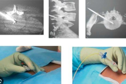 Best Musculoskeletal Interventions in Sector 49, Faridabad