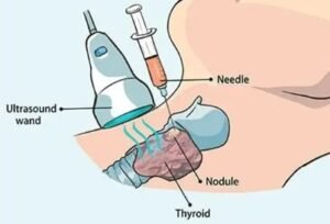 Best FNAC Biopsy Hospital in Sector 21C, Faridabad