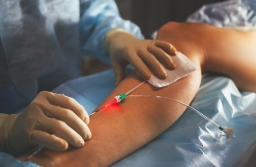 Varicose Vein Treatment in Sector 21, Faridabad