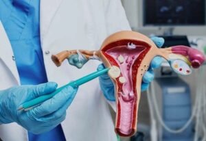 Uterine Fibroid Bleeding Treatment in Faridabad