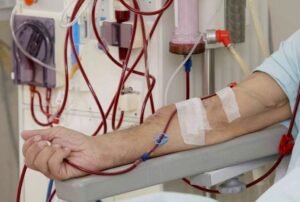 Kidney Dialysis Procedures in Sector 21, Faridabad