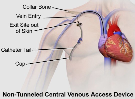 Best Central Vascular Interventions in Faridabad