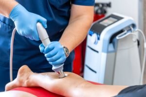 Best Varicose Veins Treatment in Faridabad