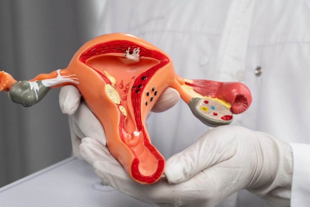 Uterine Artery Embolisation Doctor in Gurgaon