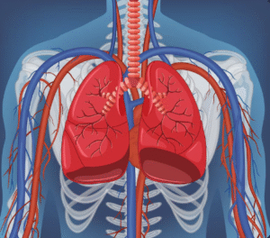 Bronchial Artery Embolization in Gurgaon
