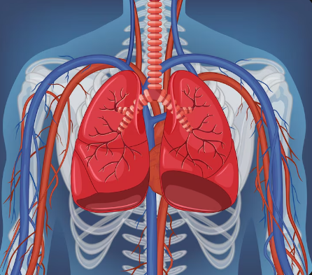 Bronchial Artery Embolization in Gurgaon