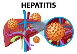 Hepatobiliary Interventions Treatment in Gurugram