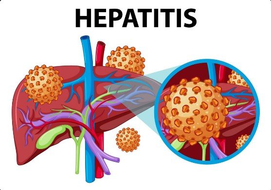 Hepatobiliary Interventions Treatment in Gurugram