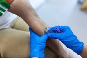 Portal Vein Intervention in Gurugram