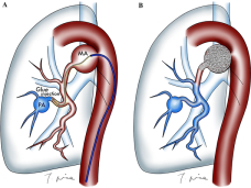 Thoracic Interventions in Faridabad