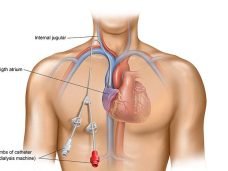 expert central vascular interventions in Faridabad by Dr. Pulkit Rangarh. Advanced diagnosis, minimally invasive treatments, and trusted vascular care.