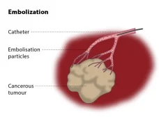 expert GI and hepatobiliary interventions in Faridabad. Advanced treatments by Dr. Pulkit Rangarh for your digestive & liver health. Book now!