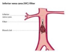 expert central vascular interventions in Faridabad by Dr. Pulkit Rangarh. Advanced diagnosis, minimally invasive treatments, and trusted vascular care.